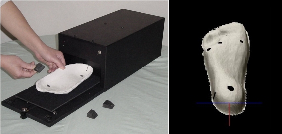 Sharp Shape AOMS 3D Laser Plaster Cast Foam Scanner